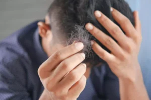 Creatina e queda de cabelo: o que realmente acontece