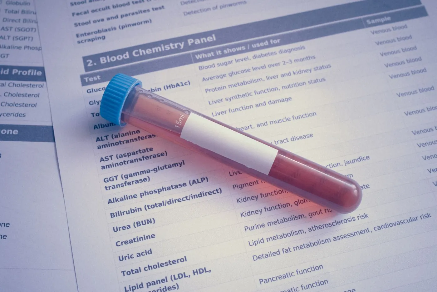 Tubo de sangue sobre um painel de exames de glicemia e colesterol